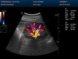 DCU30Vet Color Doppler Ultrasound | Veterinary Ultrasounds