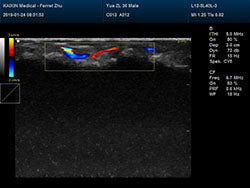 DCU30Vet Color Doppler Ultrasound | Veterinary Ultrasounds